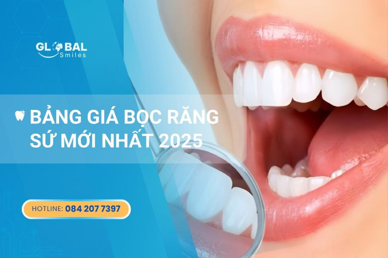 Bảng giá bọc răng sứ 2025 – Bí mật đằng sau nụ cười đẹp