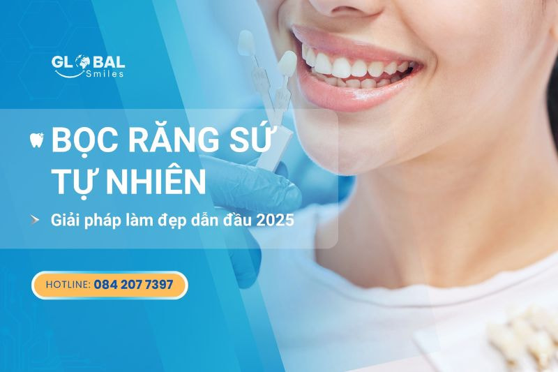 Bọc Răng Sứ Tự Nhiên – Giải Pháp Làm Đẹp Dẫn Đầu 2025