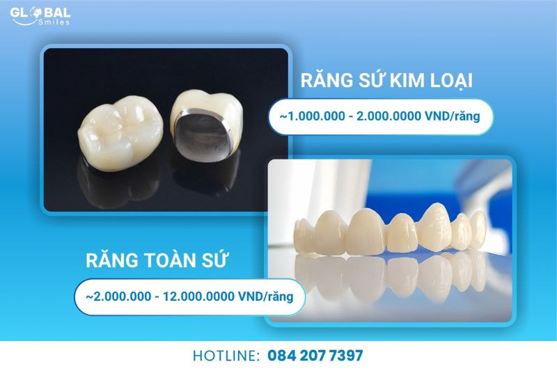 Tham khảo chi phí cho từng loại răng