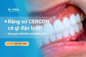 răng sứ cercon