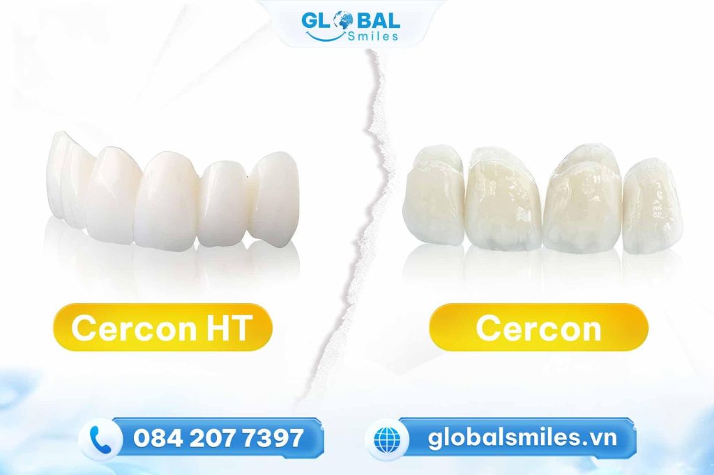 răng sứ cercon và răng sứ cercon ht