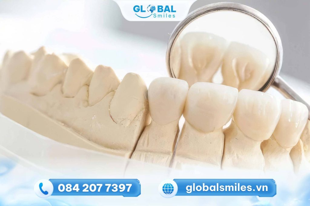 răng sứ zirconia là gì