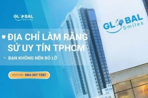 Top địa chỉ làm răng sứ uy tín tại TP.HCM không nên bỏ qua!