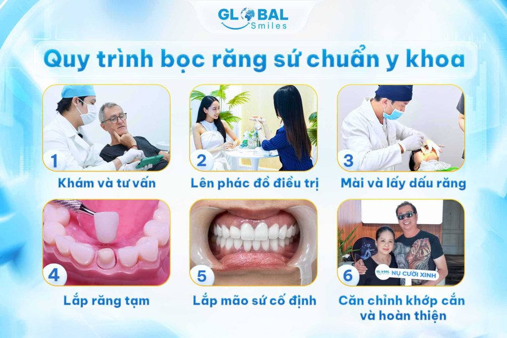 Quy trình boc răng sứ chuẩn bị khoa