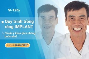quy trình trồng răng implant