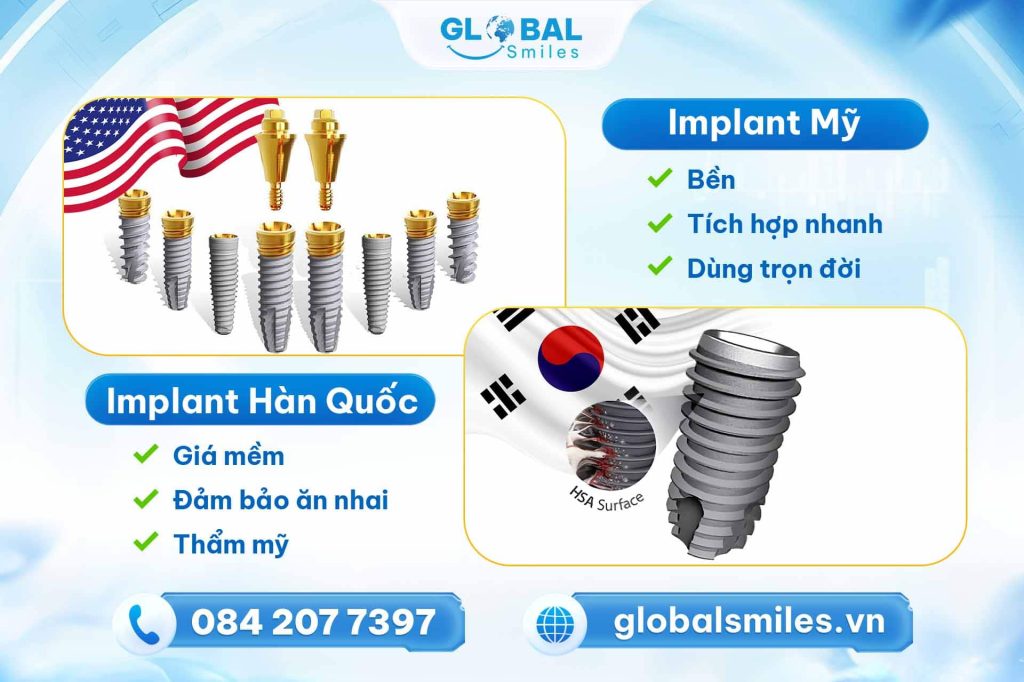 So sánh trụ Implant Mỹ và Implant Hàn Quốc