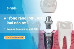 trồng răng implant loại nào tốt