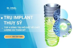 Implant Thụy Sỹ – Top 4 trụ nổi bật về chất lượng và thẩm mỹ
