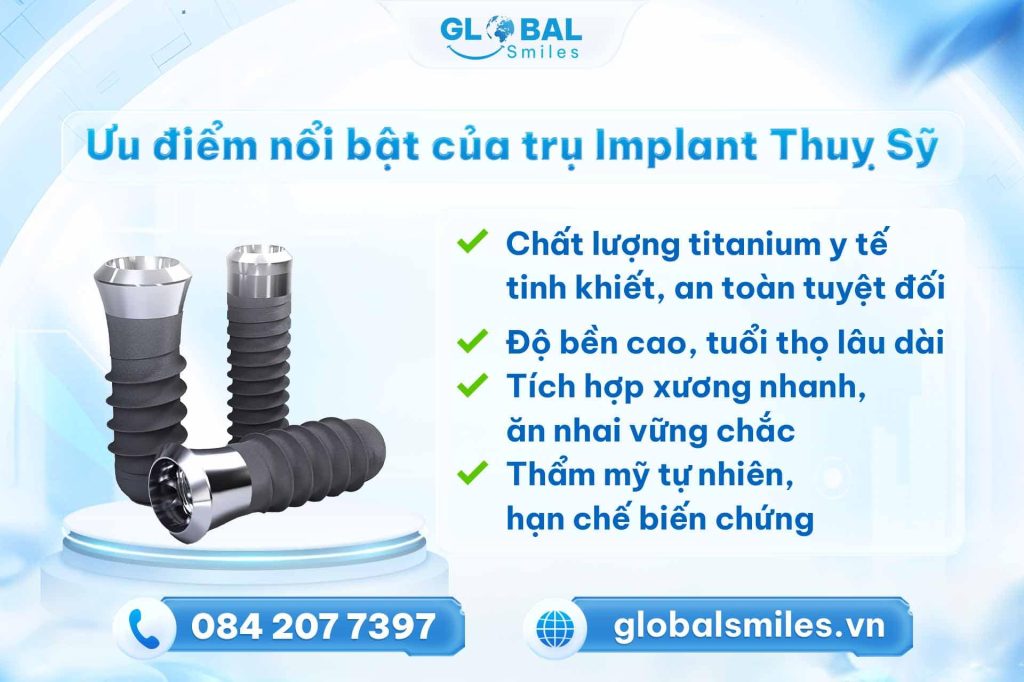 Ưu điểm nổi bật của trụ Implant Thuỵ Sỹ