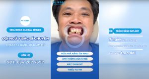 Hành trình thay đổi ngoạn mục sau khi cấy ghép Implant của Nha Khoa Global Smiles