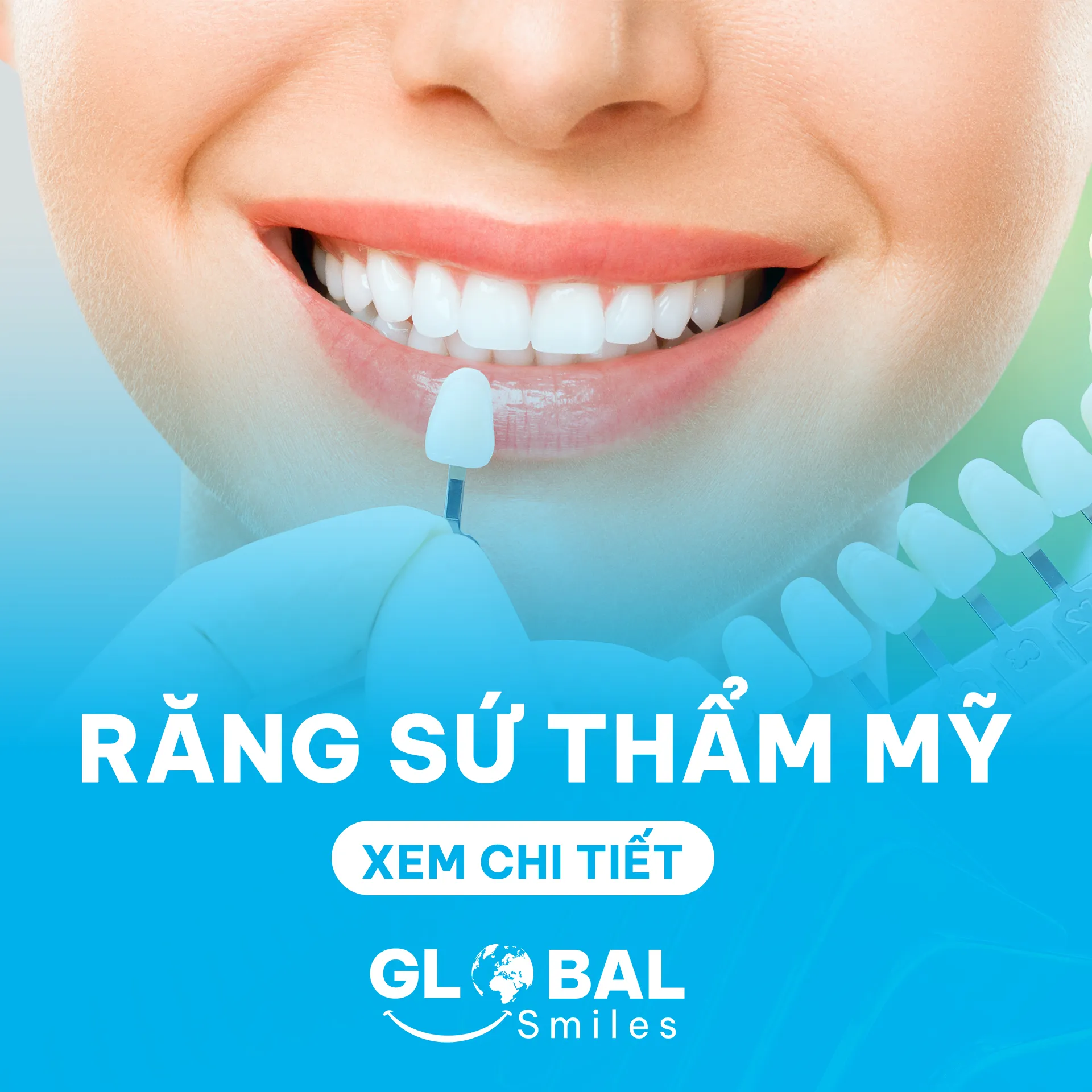 Rang-su-tham-my-Nha Khoa Global Smiles